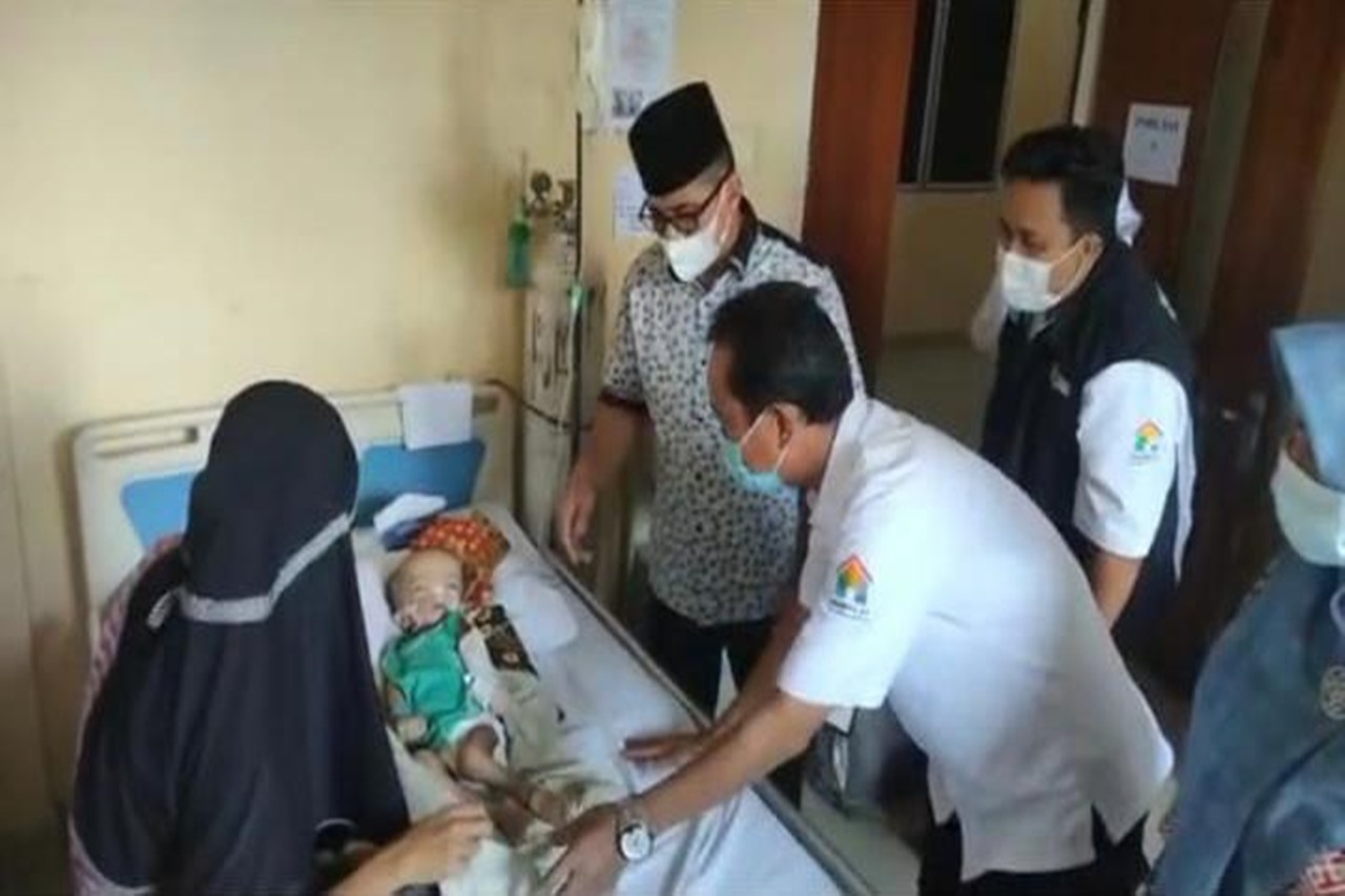 Kemensos Respon Kasus Bayi Penderita Gizi Buruk di Indragiri Hilir