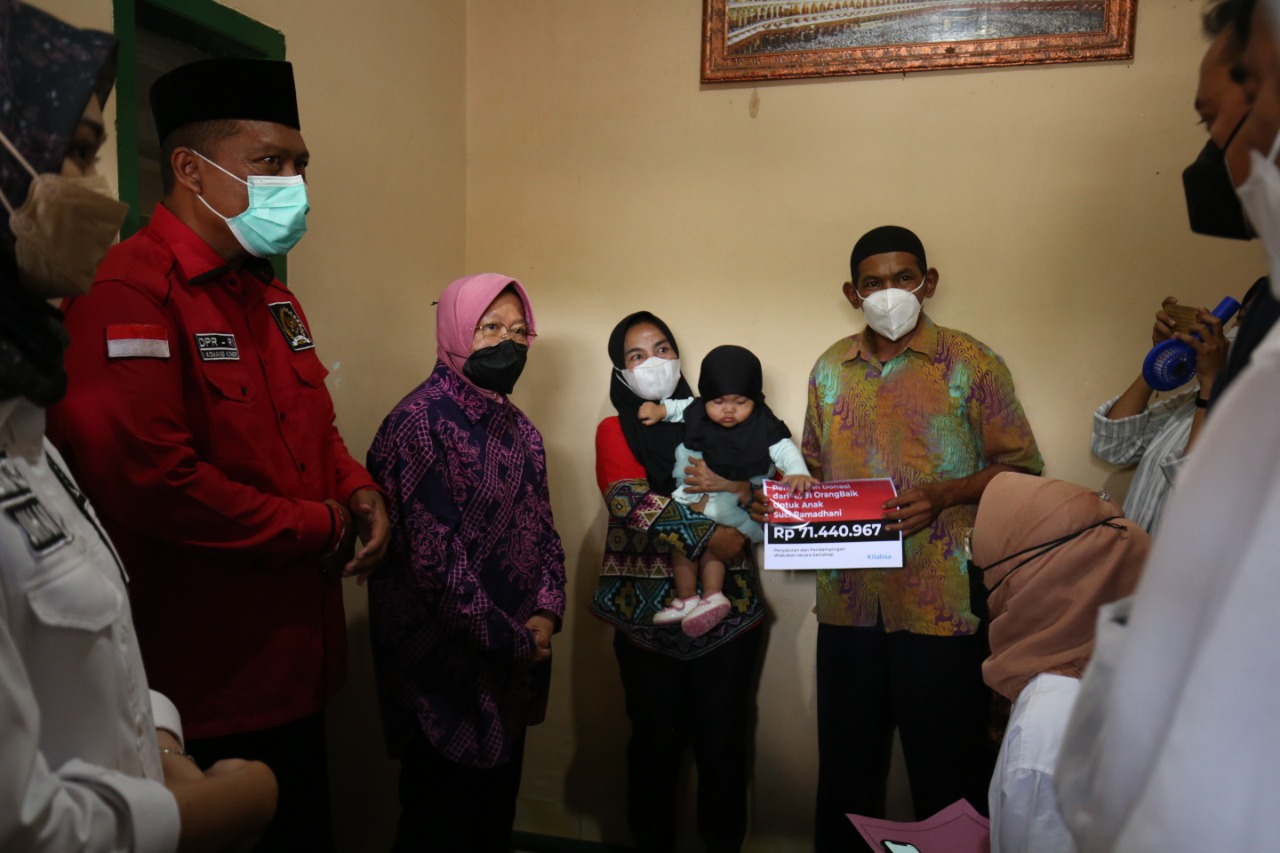 Kemensos Peduli Bayi Penderita Tumor Mata