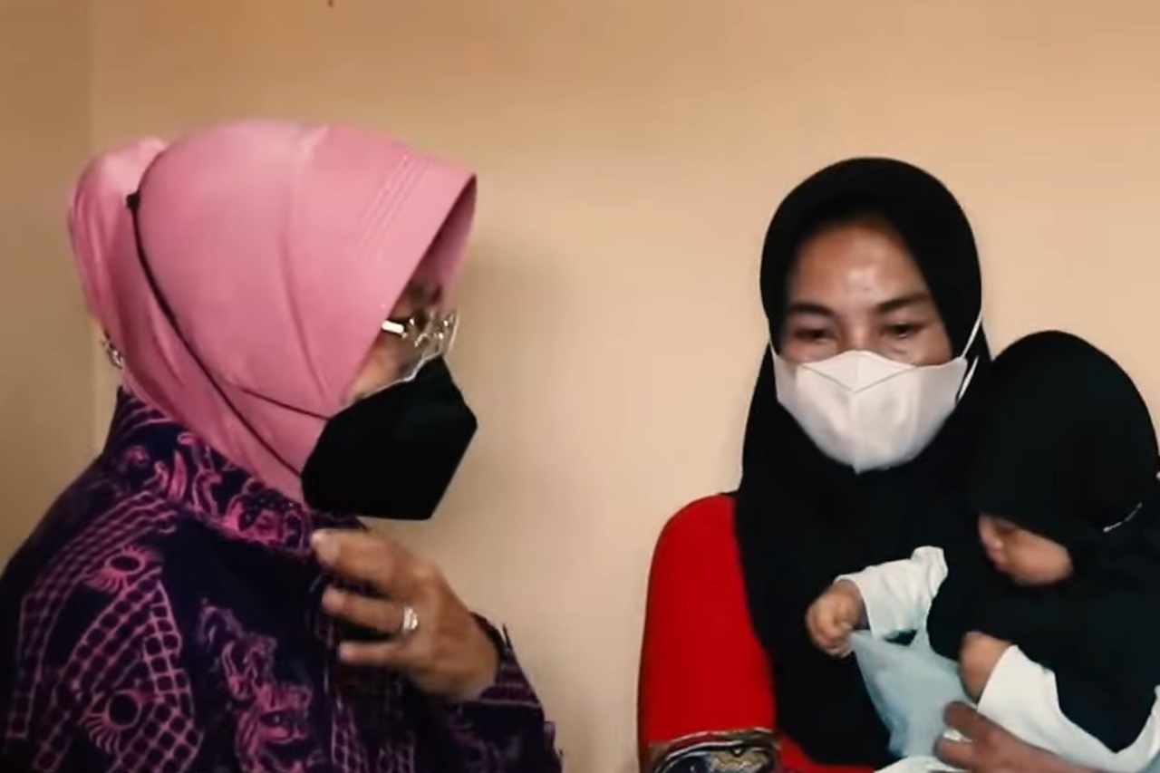 Social Affairs Minister Assists Suci, Baby with Eye Tumor